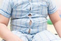 Obese boy overweight. Tight shirt of pajamas Royalty Free Stock Photo
