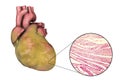 Obese heart, illustration Royalty Free Stock Photo