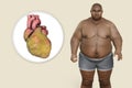 Obese heart in overweight man, 3D illustration. Concept of obesity and inner organs disease