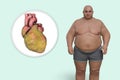 Obese heart in overweight man, 3D illustration. Concept of obesity and inner organs disease