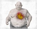 Obese heart in overweight man, 3D illustration. Concept of obesity and inner organs disease