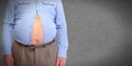 Obese man abdomen. Royalty Free Stock Photo