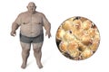 Obese man and close-up view of fat cells, 3D illustration. Concept of obesity