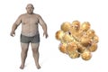 Obese man and close-up view of fat cells, 3D illustration. Concept of obesity