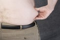 Obese Man Grabbing Fat On The Stomach