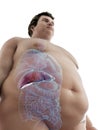 An obese mans liver Royalty Free Stock Photo