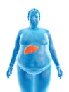 An obese mans liver Royalty Free Stock Photo