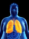 An obese mans lungs Royalty Free Stock Photo