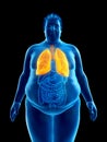 An obese mans lungs Royalty Free Stock Photo