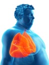 An obese mans lungs Royalty Free Stock Photo
