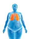 An obese mans lungs Royalty Free Stock Photo