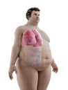 An obese mans lungs Royalty Free Stock Photo
