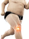 An obese runners painful knee Royalty Free Stock Photo