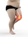 an obese runners painful knee Royalty Free Stock Photo