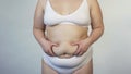 Obese woman touching saggy belly, overweight insecurities problem, unsatisfied