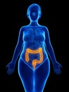 An obese womans colon Royalty Free Stock Photo