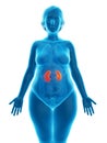 an obese womans kidneys Royalty Free Stock Photo