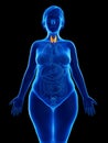 an obese womans thyroid gland Royalty Free Stock Photo