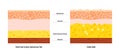 Obesity fat level