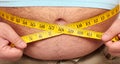 Obesity Royalty Free Stock Photo