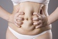 Obesity female body, fat woman belly close up Royalty Free Stock Photo
