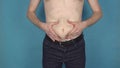 Man with fat belly touches and shakes his abdomen. Male health and diet. Wide waist, figure. Obesity, graceless body