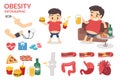 Obesity. Healthy infographic. Fat man. Obesity man. Royalty Free Stock Photo