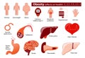 Obesity and overweight infographic Royalty Free Stock Photo