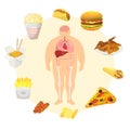 Obesity problem with fat mans body with and fast food infographic icons vector illustration. Excess weight problem, fat