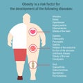 Obesity Vector illustration
