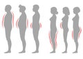 Obesity woman and man body type, vector figure overweight silhouette