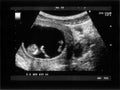 Obstetric Ultrasonography Royalty Free Stock Photo