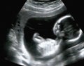 Obstetric Ultrasonography Ultrasound Echography of a first month Royalty Free Stock Photo
