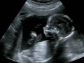 Obstetric Ultrasonography Ultrasound Echography of a first month Royalty Free Stock Photo