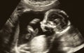 Obstetric Ultrasonography Ultrasound Echography of a first month Royalty Free Stock Photo