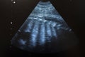 Obstetric Ultrasonography Ultrasound Echography of pregnant.