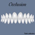 Occlusion clenched teeth