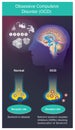 OCD. Psychiatric symptoms that need to check things repeatedly