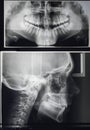 Odontostomalogical radiographs, digital orthopantomography for dental diagnosis