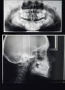 Odontostomalogical radiographs, digital orthopantomography for dental diagnosis