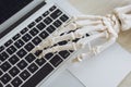 Office syndrome concept. Skeleton hand bone joint wrist pain physical effect when typing laptop computer