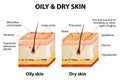 Oily & dry skin Royalty Free Stock Photo