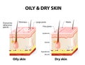 Oily & dry skin