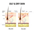 Oily and dry skin