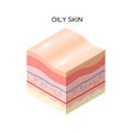 Oily skin cross-section of human skin layers structure skincare medical concept flat