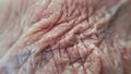 Old aged human chapped Wrinkled skin macro closeup View , skin textured