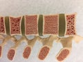 Old anatomical model of human vertebral column