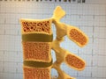 Old anatomical model of human vertebral column Royalty Free Stock Photo