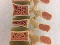 Old anatomical model of human vertebral column Royalty Free Stock Photo