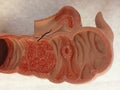 Old anatomical model of Colon with examples of different diseases Royalty Free Stock Photo